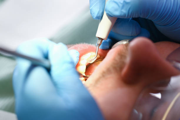Best Emergency Gum Pain Relief  in White Sulphur Springs, WV